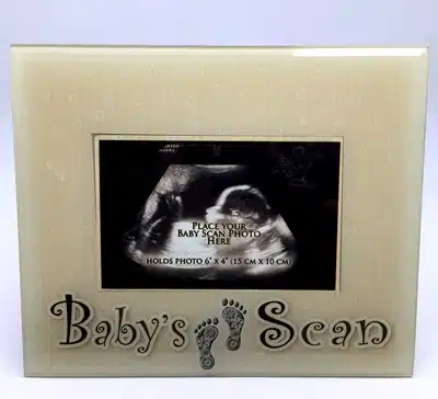 Photo Frame For Baby Scan